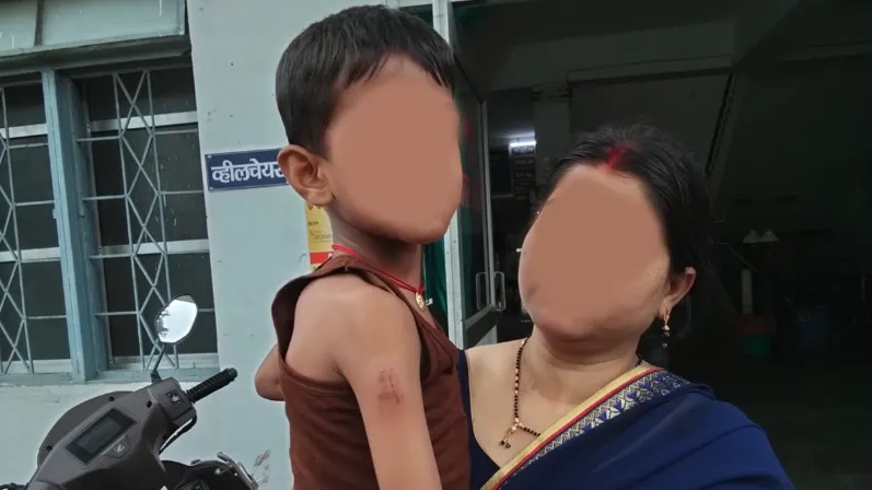 कुत्तों ने काटा