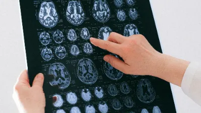 World Brain Tumor Day