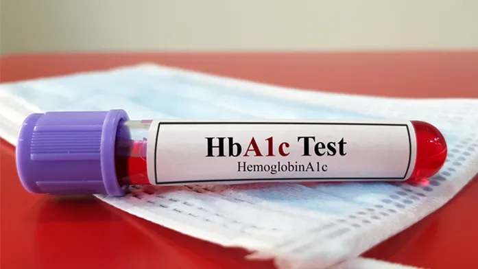 HbA1c Test