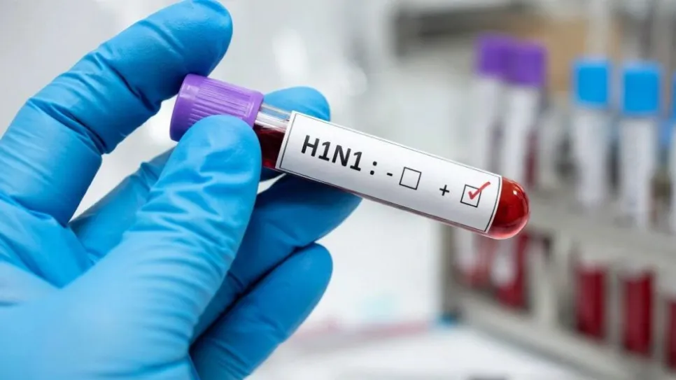 Swine Flu
