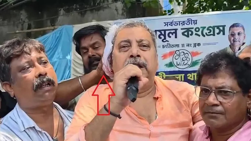 कल्याण बनर्जी चोटिल