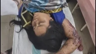 आईईडी की चपेट में आई महिला