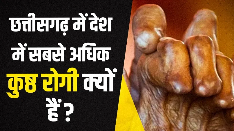 कुष्ठ