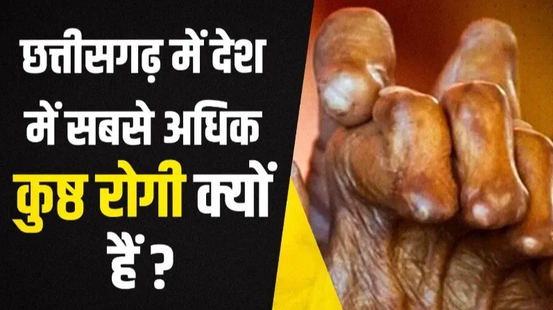 कुष्ठ रोग