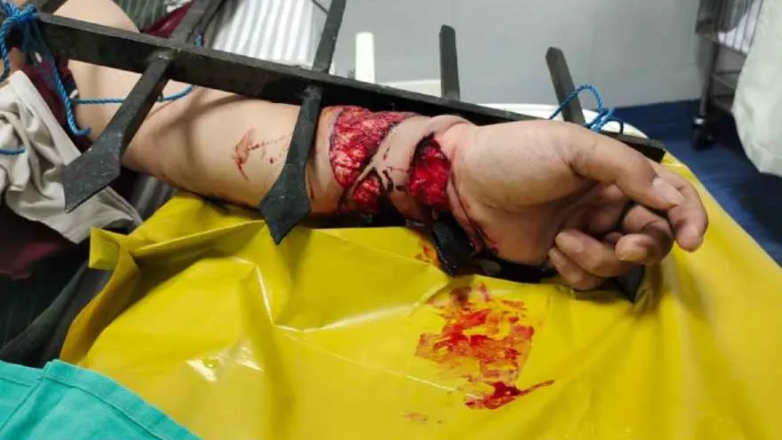 Doctors, engineers and mechanics led an impossible surgery