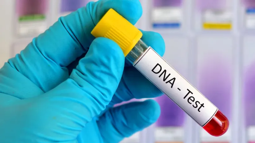 DNA Test
