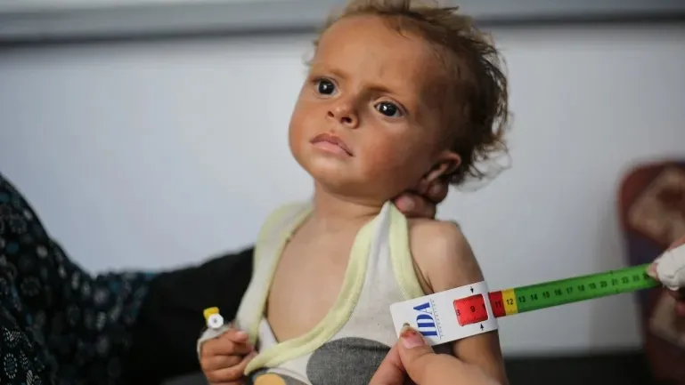 Man made Famine in Gaza triggers Global alarm