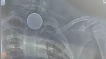 X Ray